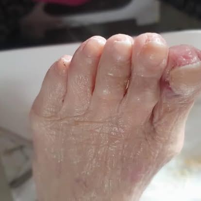 After — Treatment