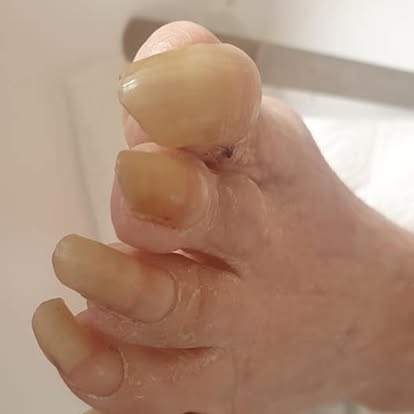 Before — Treatment